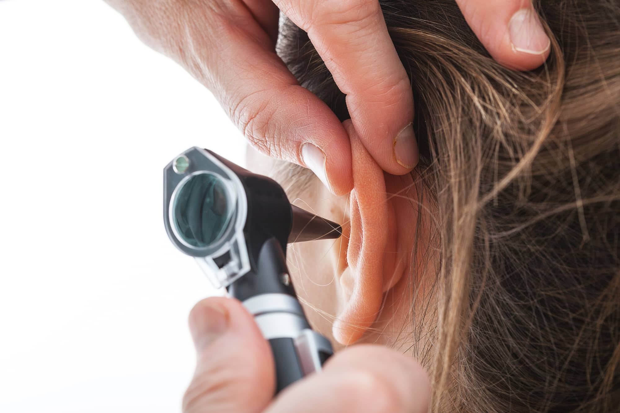 cauliflower ear